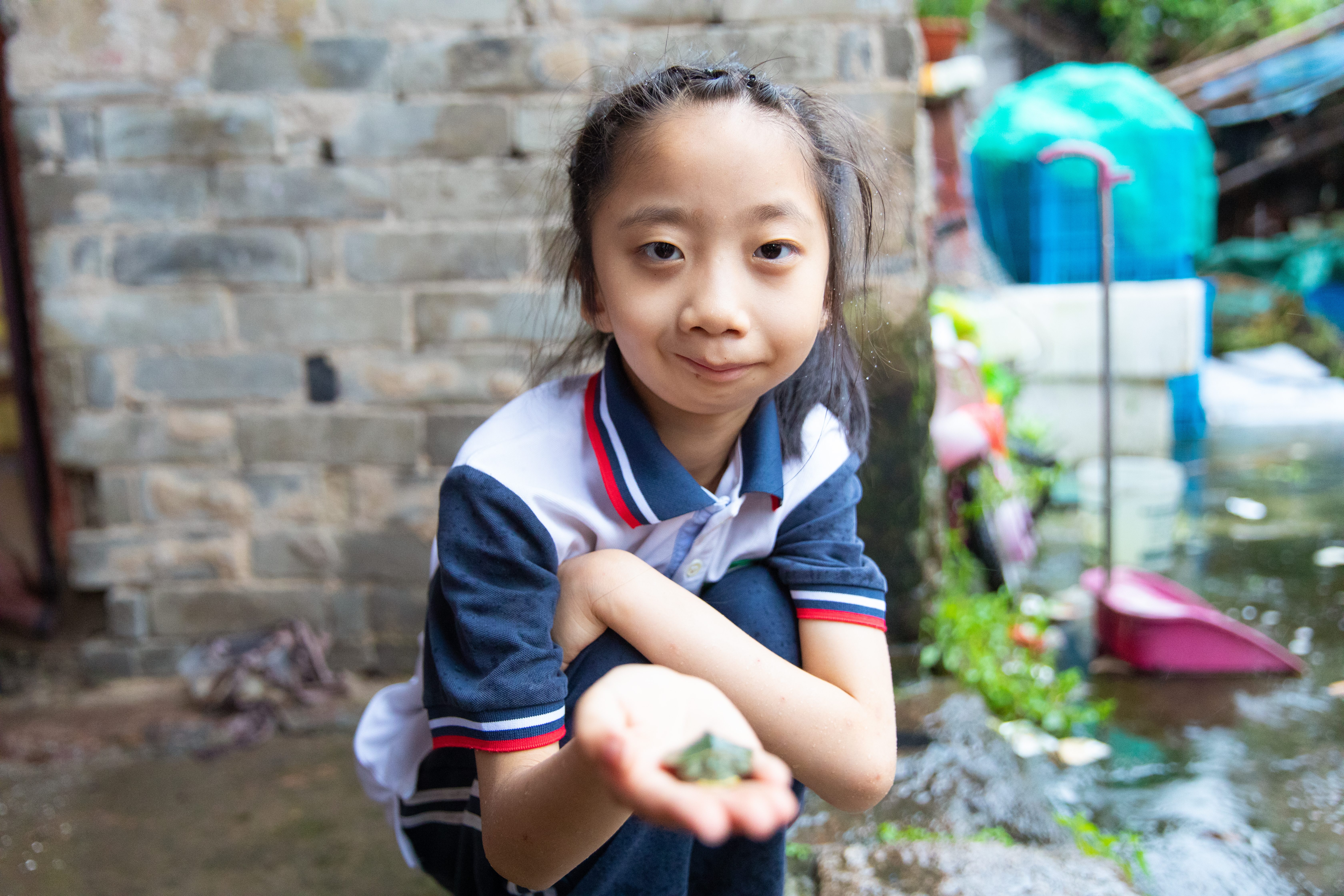 八年間三次手術(shù) 先天性“無(wú)嘴”小孩的重建人生